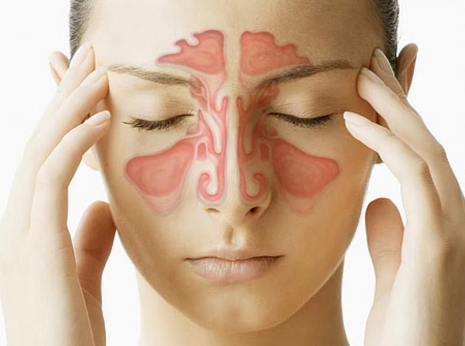 sinusitis zdravljenje s tradicionalno kitajsko medicino