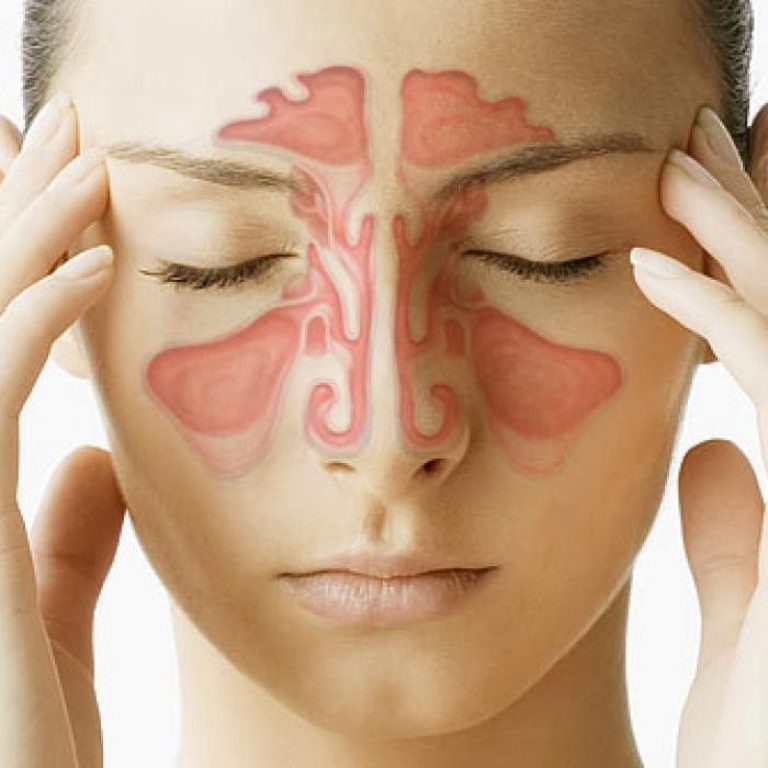 sinusitis zdravljenje s tradicionalno kitajsko medicino